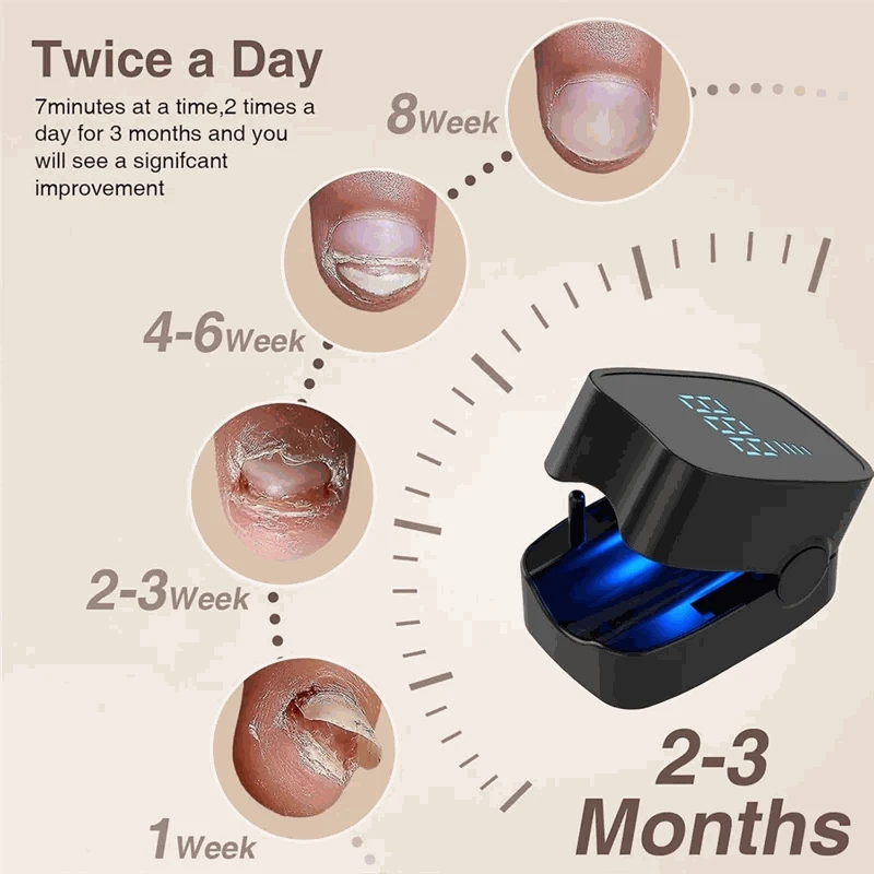 Pro Nagelpilz Laser Pflegegerät für Zuhause